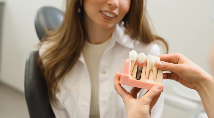 Avantajele unui implant dentar. Iată ce trebuie să știi Avantajele unui implant dentar. Iată ce trebuie să știi
