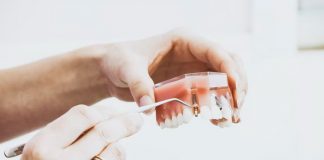 Implant sau punte dentară? Diferențe, caracteristici și avantaje Implant sau punte dentară? Diferențe, caracteristici și avantaje