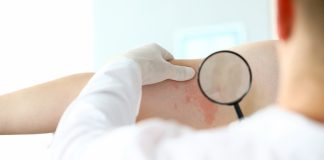 3 boli inflamatorii rare și ce trebuie să știi despre ele 3 boli inflamatorii rare și ce trebuie să știi despre ele